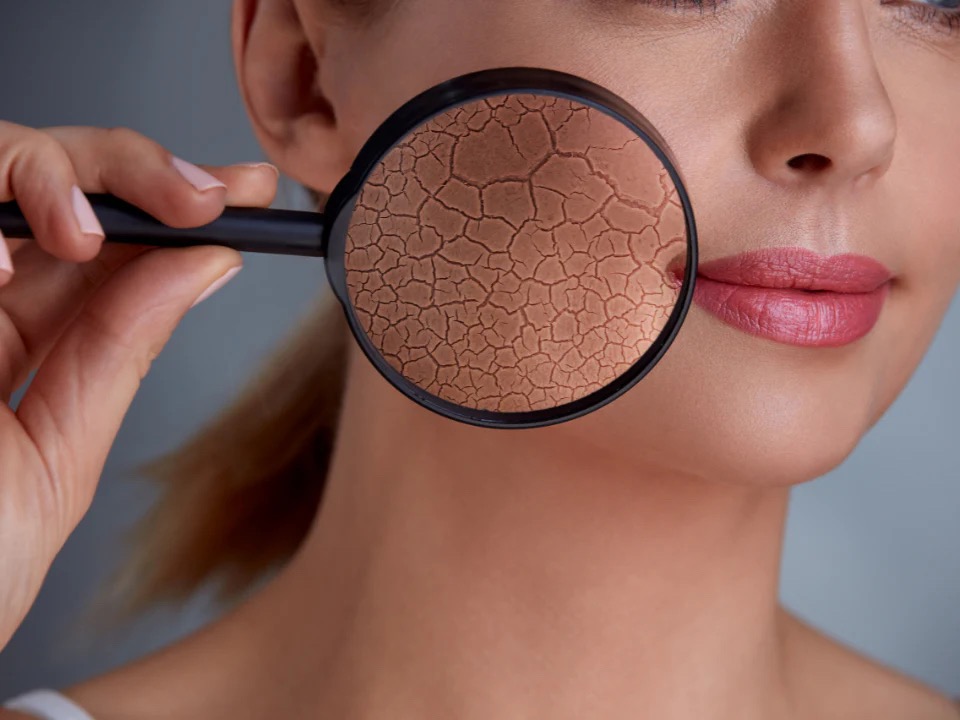 Faktor-faktor yang Membuat Barier Kulit Melemah